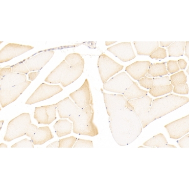 Nitric Oxide Synthase 2, Inducible (NOS2) Human Polyclonal Antibody