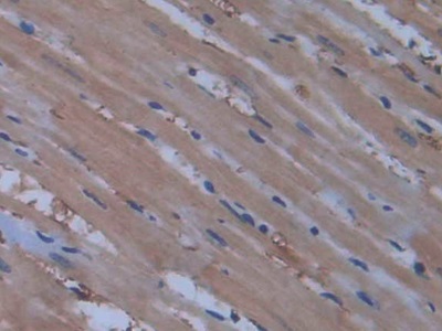 Nitric Oxide Synthase 2, Inducible (NOS2) Rat Polyclonal Antibody