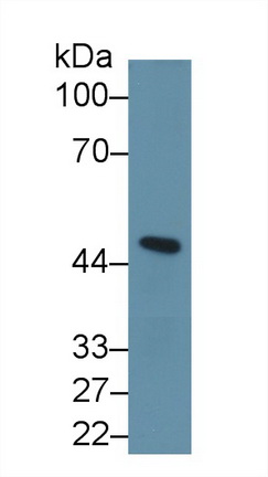 Inhibin Beta A (INHbA) Human Polyclonal Antibody