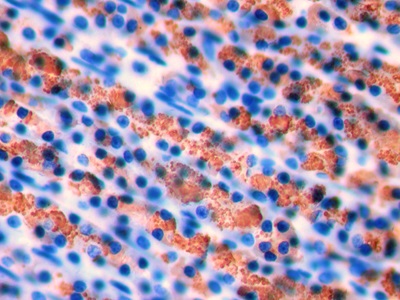 Inhibin Beta A (INHbA) Rat Polyclonal Antibody