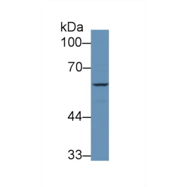 Coagulation Factor IX (F9) Human Polyclonal Antibody