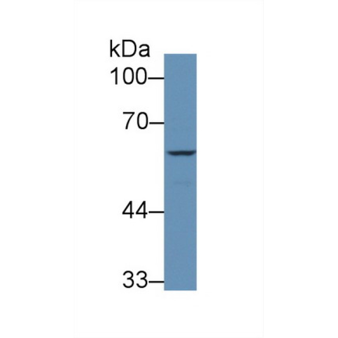 Coagulation Factor IX (F9) Human Polyclonal Antibody