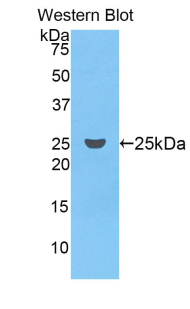 Coagulation Factor IX (F9) Rat Polyclonal Antibody