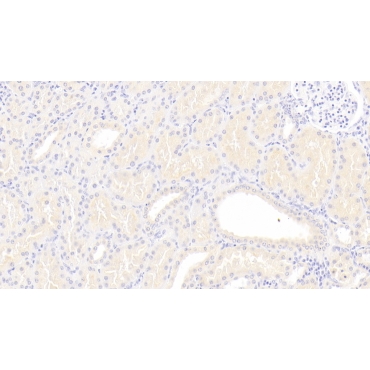 Lipoprotein, a (Lpa) Human Polyclonal Antibody