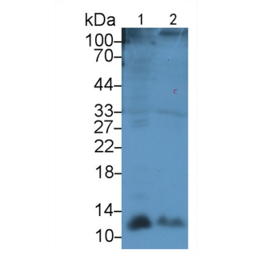 Gonadotropin Releasing Hormone (GnRH) Human Polyclonal Antibody