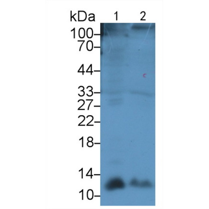 Gonadotropin Releasing Hormone (GnRH) Human Polyclonal Antibody