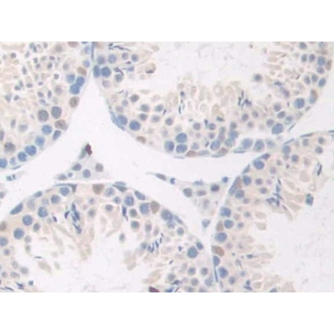 Gonadotropin Releasing Hormone (GnRH) Mouse Polyclonal Antibody