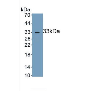 Glycogen Phosphorylase, Brain (PYGB) Mouse Polyclonal Antibody