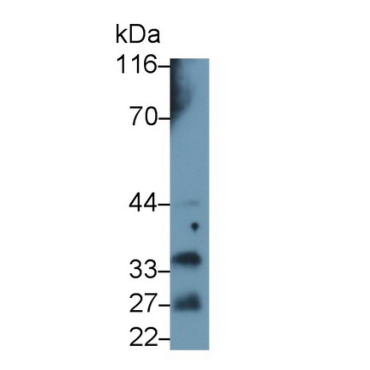Prolactin (PRL) Human Polyclonal Antibody