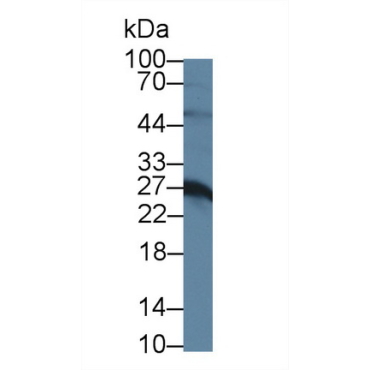 Prolactin (PRL) Mouse Polyclonal Antibody
