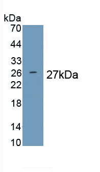 Prolactin (PRL) Pig Polyclonal Antibody