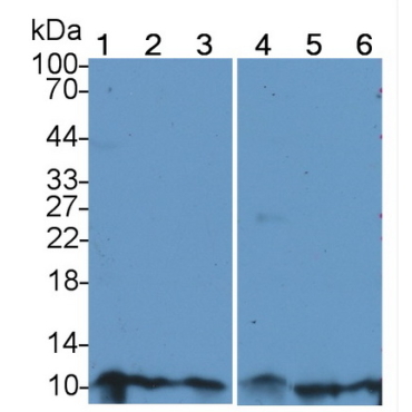 Resistin (RETN) Human Polyclonal Antibody