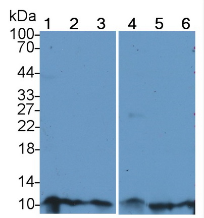 Resistin (RETN) Human Polyclonal Antibody