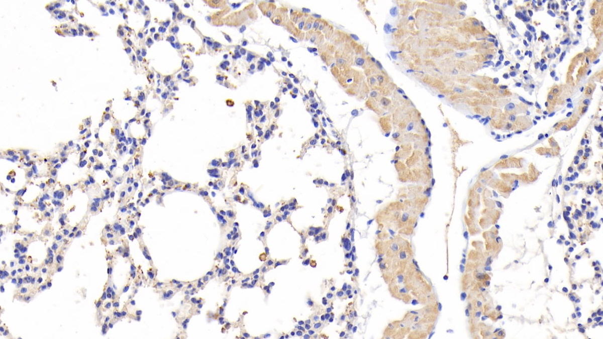 Resistin (RETN) Mouse Polyclonal Antibody