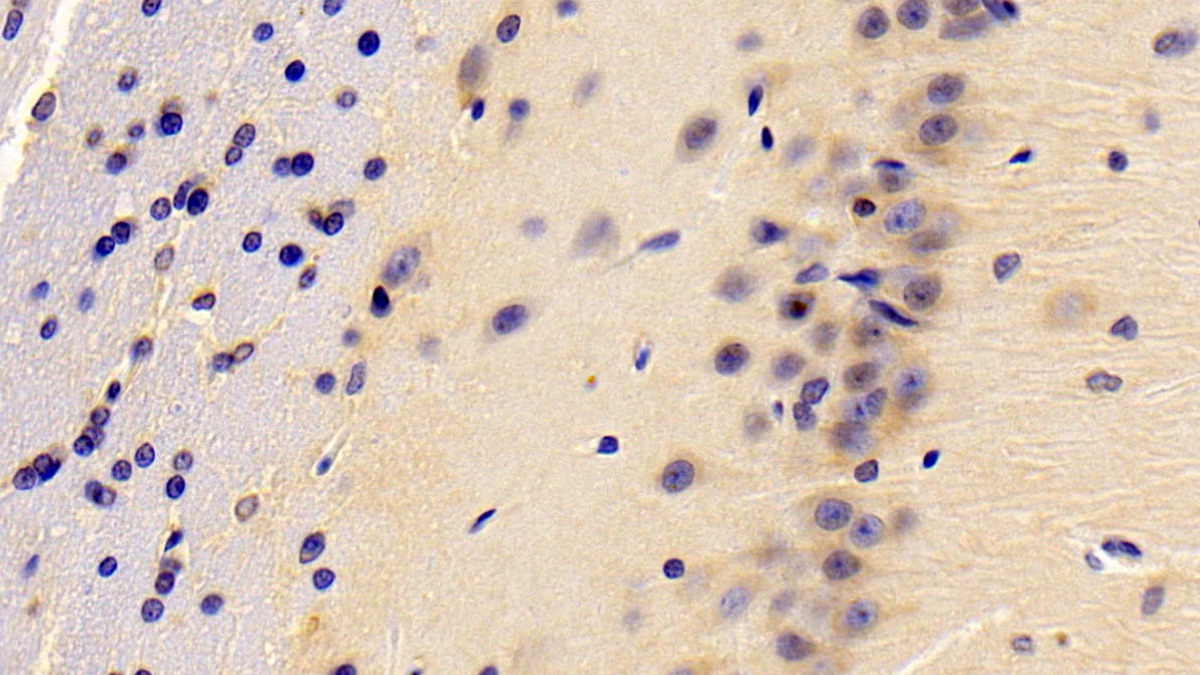 Resistin (RETN) Rat Polyclonal Antibody