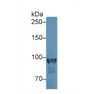Glycogen Phosphorylase, Muscle (PYGM) Mouse Polyclonal Antibody