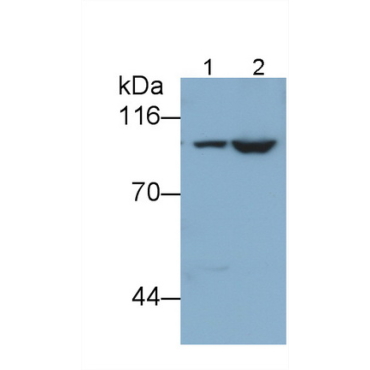 Glycogen Phosphorylase, Liver (PYGL) Human Polyclonal Antibody