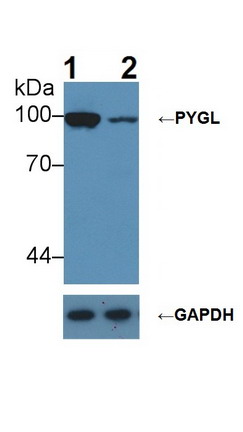 Glycogen Phosphorylase, Liver (PYGL) Rat Polyclonal Antibody