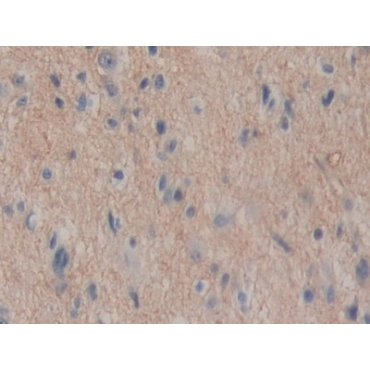 Aminopeptidase A (ENPEP) Human Polyclonal Antibody