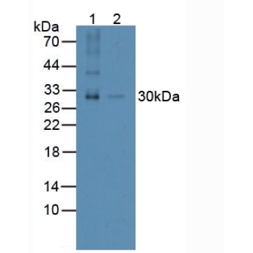 Receptor Activator Of Nuclear Factor Kappa B Ligand (RANkL) Human Polyclonal Antibody