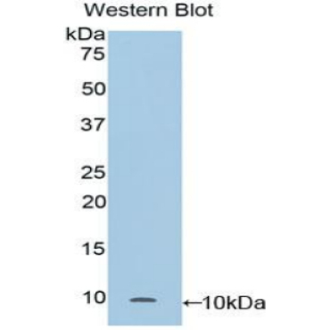 Clara Cell Protein 16 (CC16) Mouse Polyclonal Antibody