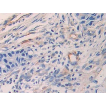 Epithelial Neutrophil Activating Peptide 78 (ENA78) Human Polyclonal Antibody
