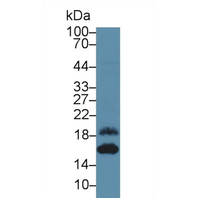 Epithelial Neutrophil Activating Peptide 78 (ENA78) Human Polyclonal Antibody