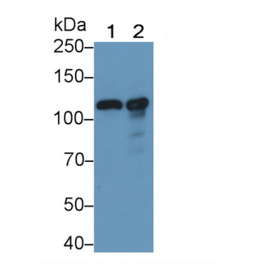 Complement Component 3 (C3) Human Polyclonal Antibody