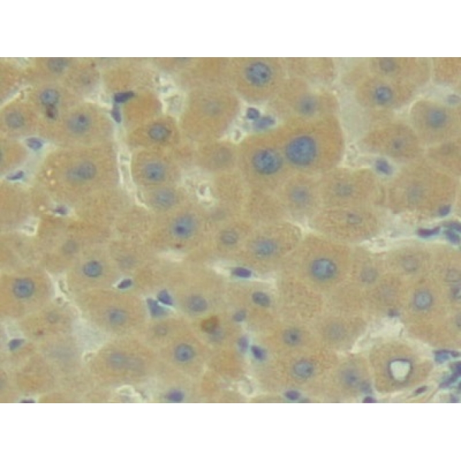 Complement Component 2 (C2) Human Polyclonal Antibody