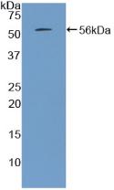 Parathyroid Hormone (PTH) Rat Polyclonal Antibody