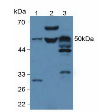 Phospholipase A2 Group VII (LpPLA2) Mouse Polyclonal Antibody