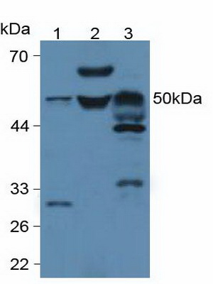 Phospholipase A2 Group VII (LpPLA2) Mouse Polyclonal Antibody