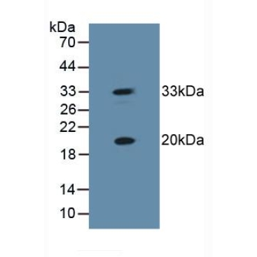 Heat Shock Protein Beta 2 (HSPb2) Human Polyclonal Antibody
