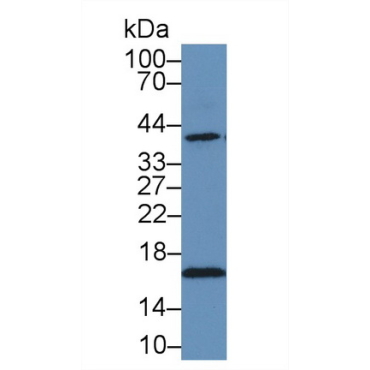 Heat Shock Protein 40 (HSP40) Human Polyclonal Antibody