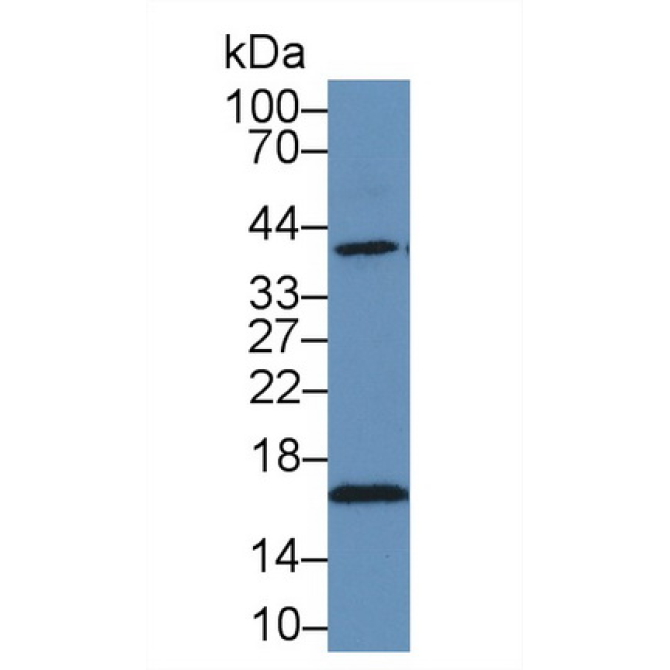 Heat Shock Protein 40 (HSP40) Human Polyclonal Antibody