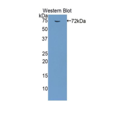 Heat Shock Protein 70 (HSP70) Human Polyclonal Antibody