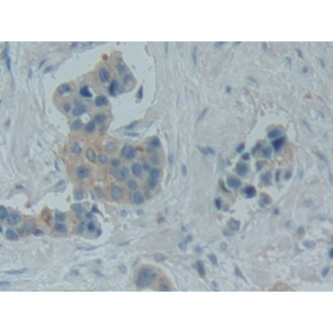 Bradykinin (BK) Human Polyclonal Antibody