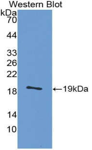 Calcitonin Gene Related Peptide (CGRP) Human Polyclonal Antibody