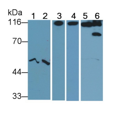 Cluster Of Differentiation 26 (CD26) Human Polyclonal Antibody
