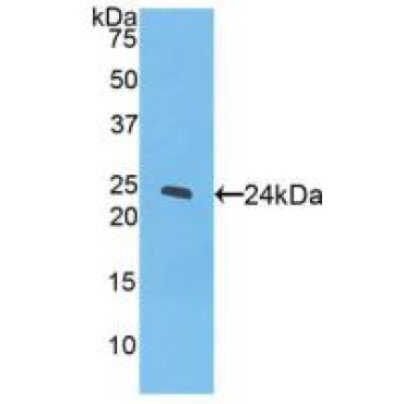 Peroxisome Proliferator Activated Receptor Gamma (PPARg) Bovine (Cattle) Polyclonal Antibody