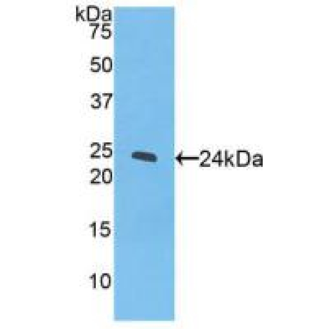 Peroxisome Proliferator Activated Receptor Gamma (PPARg) Bovine (Cattle) Polyclonal Antibody