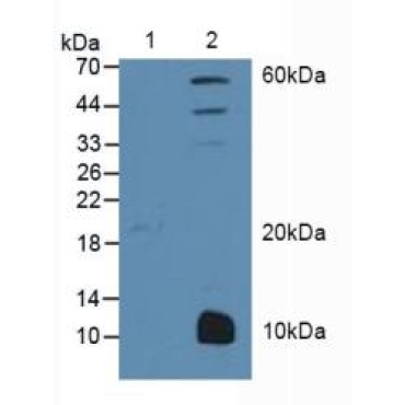 Peroxisome Proliferator Activated Receptor Gamma (PPARg) Human Polyclonal Antibody