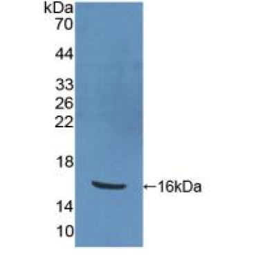Peroxisome Proliferator Activated Receptor Gamma (PPARg) Human Polyclonal Antibody