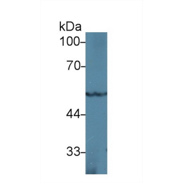 Peroxisome Proliferator Activated Receptor Gamma (PPARg) Mouse Polyclonal Antibody
