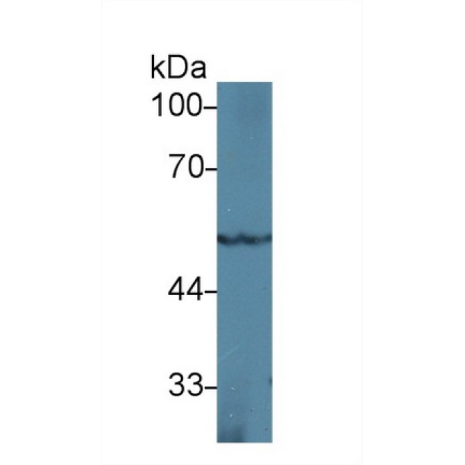 Peroxisome Proliferator Activated Receptor Gamma (PPARg) Mouse Polyclonal Antibody
