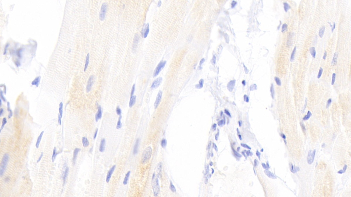 Peroxisome Proliferator Activated Receptor Gamma (PPARg) Rabbit Polyclonal Antibody