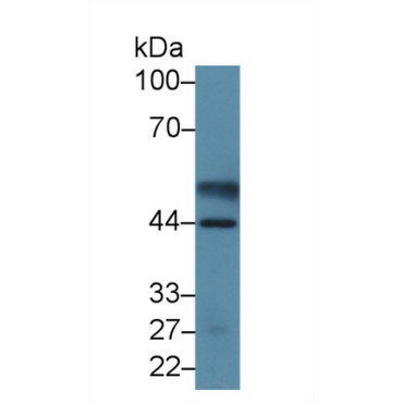 Pyruvate Dehydrogenase Phosphatase (PDP) Human Polyclonal Antibody