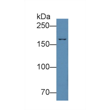 Complement Component 4 (C4) Mouse Polyclonal Antibody