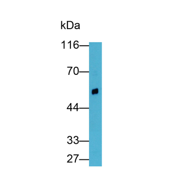 Renin (REN) Human Polyclonal Antibody