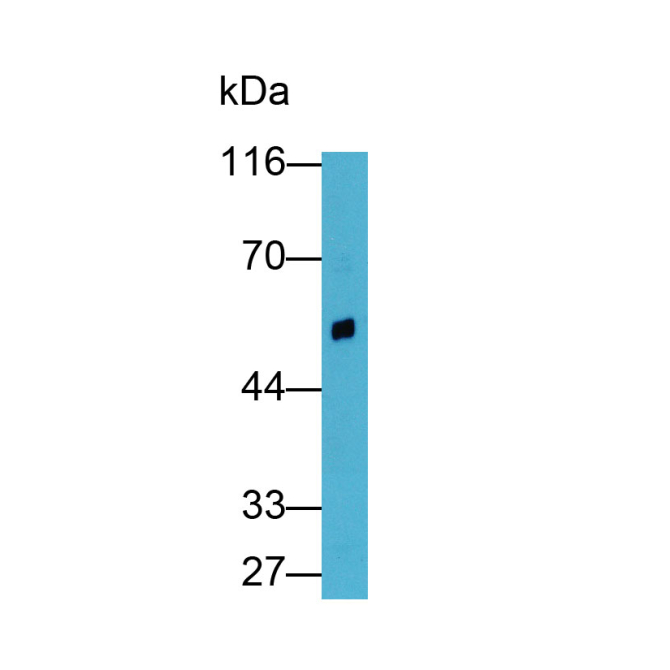 Renin (REN) Human Polyclonal Antibody